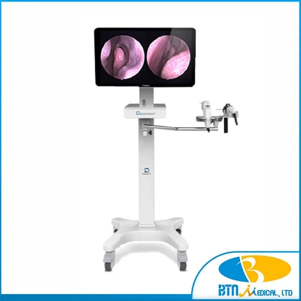 Máy nội soi tai mũi họng (độ phân giải HD) Insight-I