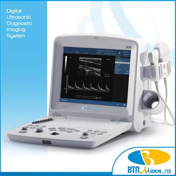 Máy siêu âm xách tay ký thuật số P3